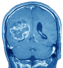 La scoperta scientifica più importante dell’anno 2012