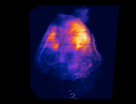 Gli effetti della cocaina sul cervello