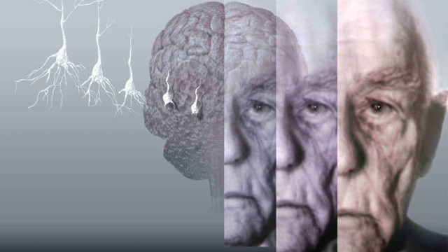 Alzheimer: scoperto legame tra abuso di farmaci da banco e rischio demenza