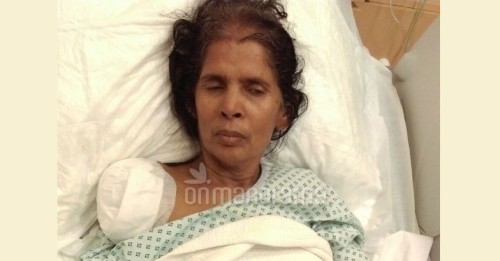 Kashturi Munirathinam: la domestica indiana, afferma che gli è stato amputato il braccio destro  dopo numerosi maltrattamenti