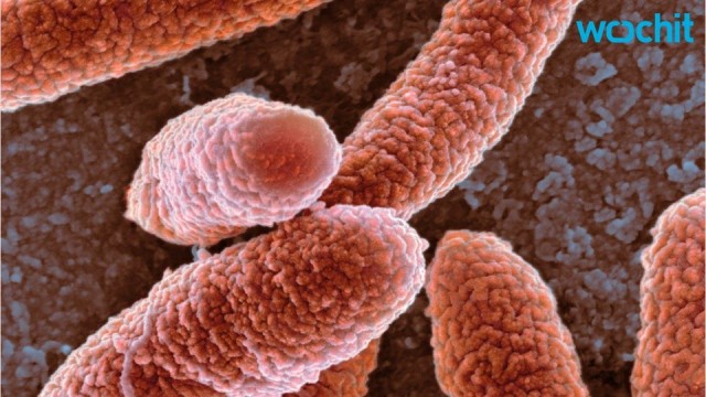 Pennsylviania: donna infetta da super bacterium escherichia coli