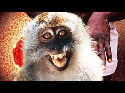 Il nuovo spaventapasseri – Il vaiolo delle scimmie?