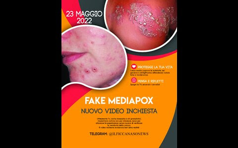 fakemediapox-tutte-le-menzogne-per-coprire-danni-del-siero-pfizer