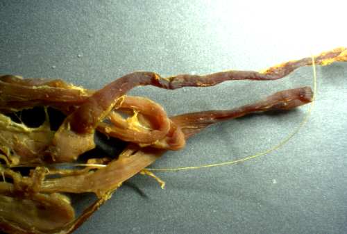 nanowire-clot-20x-png