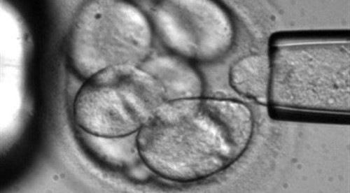 Azienda israeliana crea embrioni umani per prelevare organi, dopo aver esaminato il lavoro di un gruppo di ricerca dell'Università di Cambridge che ha creato embrioni di topo cresciuti da cellule staminali piuttosto che da spermatozoi ed ovuli.